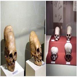 10 datos sorprendentes sobre los antiguos cráneos alargados peruanos