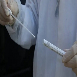 Un hombre estuvo perdiendo líquido cerebral durante meses debido a una lesión causada por una prueba PCR